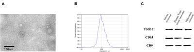 Serum Exosomal Proteins F9 and TSP-1 as Potential Diagnostic Biomarkers for Newly Diagnosed Epilepsy